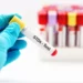 Things You Need To Know About Sexually Transmitted Diseases (STDs) 5 Things You Need To Know About Sexually Transmitted Diseases (STDs)