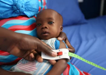 Nigeria Struggles With Child Malnutrition