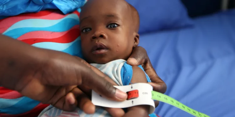 Child Malnutrition