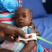 Nigeria Struggles With Child Malnutrition