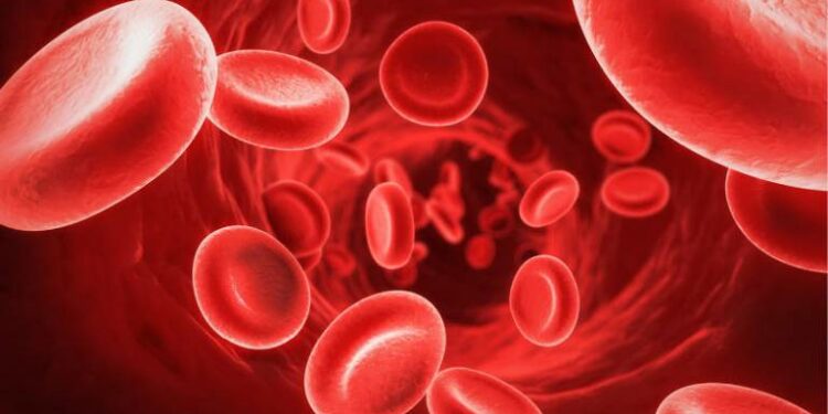 Haemophilia