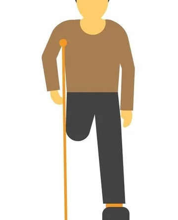 CEDE Launches Initiative To Provide Prosthetics For Amputees In 3 States 1 amputee