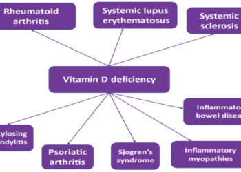 Vitamin D And Autoimmune Diseases: The Link With Rheumatoid Arthritis