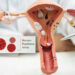 Understanding HPV: The Virus You Shouldn’t Ignore