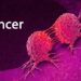 FG Collaborates With Devt Partners To Save 60m Women From Cancer 4 FG Collaborates With Devt Partners To Save 60m Women From Cancer