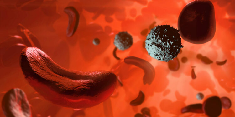 Sickle Cell Realities