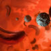 Sickle Cell Realities: The Pain We Don’t Always See