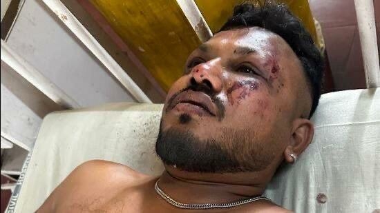 ‘I Don’t Believe How I Survived’, Sole Survivor Of Air India Crash Speaks From Hospital Bed 1 IMG 20250613 WA0014