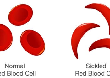 Sickle Cell And The Price Of Ignorance