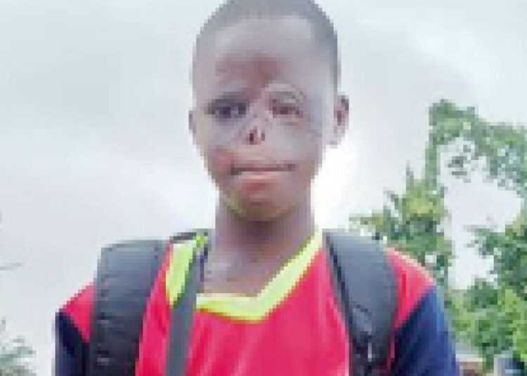 10-Year-Old Survives 10 Surgery