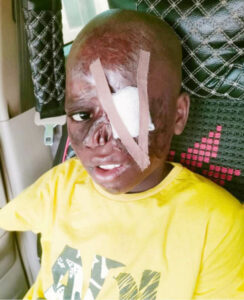10-Year-Old Survives 10 Surgery
