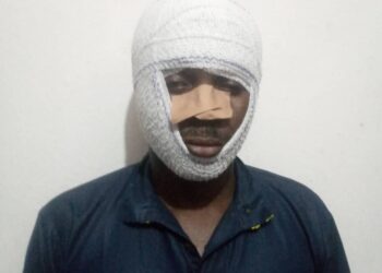 Edo Activist Brutalised In Viral Video Cries Out For Justice