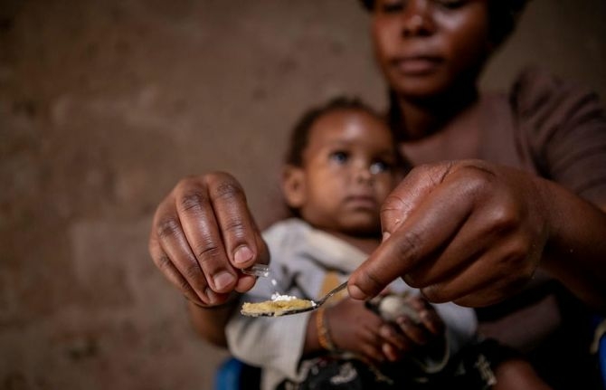 9,000 Children Infected With HIV Annually – Minister 1 Paediatric HIV