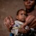 9,000 Children Infected With HIV Annually – Minister 5 Federal Gov’t Restates Commitment To Ending Paediatric HIV, Mother-to-Child Transmission