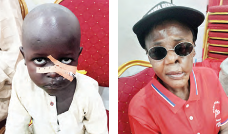 Beyond The Scars: Sokoto’s Unending Fight Against Flesh-eating NOMA Disease 1 Screenshot 2025 07 19 075817