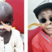 Beyond The Scars: Sokoto’s Unending Fight Against Flesh-eating NOMA Disease 5 Beyond The Scars: Sokoto’s Unending Fight Against Flesh-eating NOMA Disease
