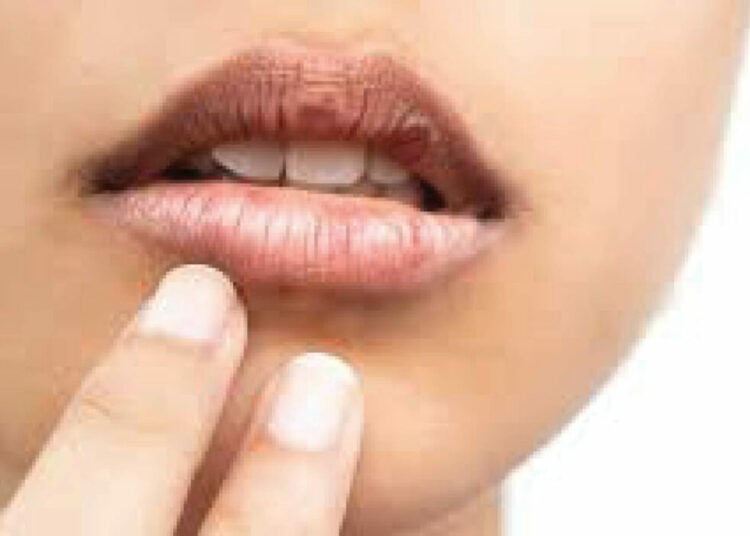 dry mouth