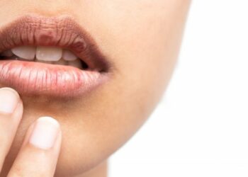 Dry Mouth, Big Problem: What Your Mouth Is Trying To  Tell You
