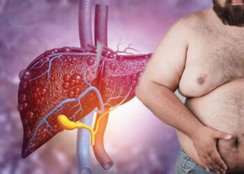 Male Breast Enlargement: An Overlooked Symptom Of Liver Disease