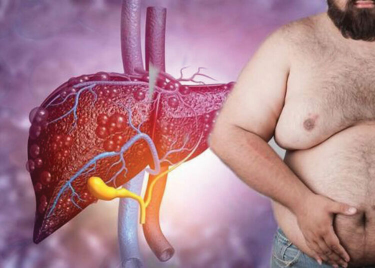 Liver Disease