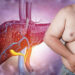 Male Breast Enlargement: An Overlooked Symptom Of Liver Disease
