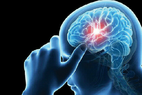 Headache Or Migraine? What Your Body Is Signaling 1 Screenshot 2025 09 14 062546