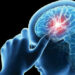 Headache Or Migraine? What Your Body Is Signaling 5 Sibling Bullies, Worse Than You Think