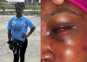 Outrage As Police Allegedly Free Suspect In Viral Naked Assault Video