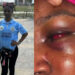 Outrage As Police Allegedly Free Suspect In Viral Naked Assault Video