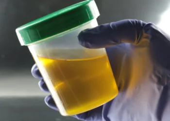 Why Drinking Urine Is A Risky Health Trend