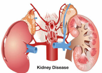 Rising Drug Abuse Among Youths Fuelling Kidney, Liver Diseases – Expert