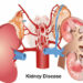 Rising Drug Abuse Among Youths Fuelling Kidney, Liver Diseases – Expert 5 Rising Drug Abuse Among Youths Fuelling Kidney, Liver Diseases – Expert