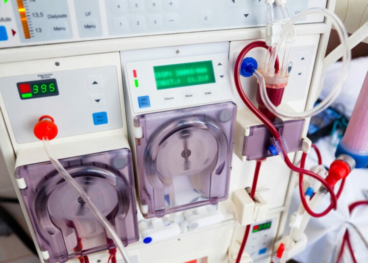 arlificial kidney (dialysis) device with rotating pumps. closeup view.