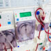 Free Dialysis: Yobe Set To Establish New Treatment Centre In Gashu’a