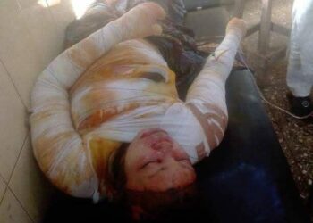 Woman Dies After Setting Self Ablaze In Bauchi