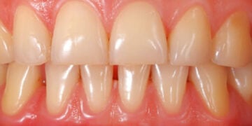 Pharmacists Are Strategic Partners In Building Healthier Societies Natural Remedies For Fresh Breath And Healthy Gums