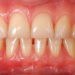 Natural Remedies For Fresh Breath And Healthy Gums 5 Natural Remedies For Fresh Breath And Healthy Gums