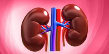 Milestones on my journey How Smart Nutrition Can Prevent, Manage Kidney Disease