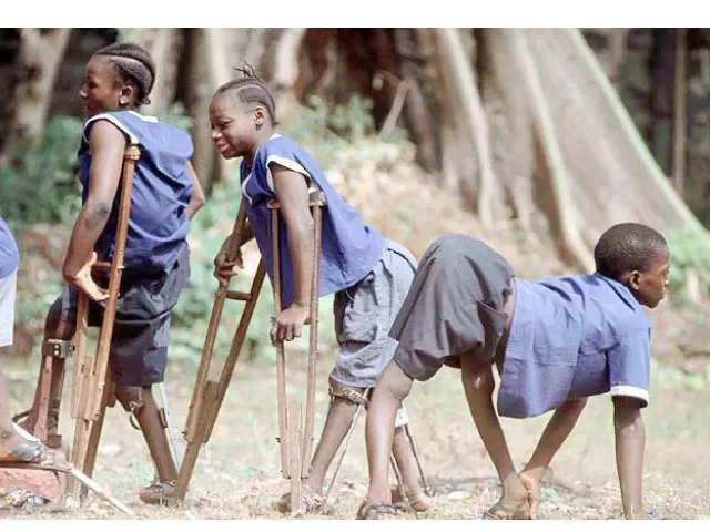 Polio Cases Drop By 44% Nationwide — NEC 1 polio victims