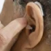 Expert Decries Rising Hearing Impairment Cases 5 Expert Decries Rising Hearing Impairment Cases