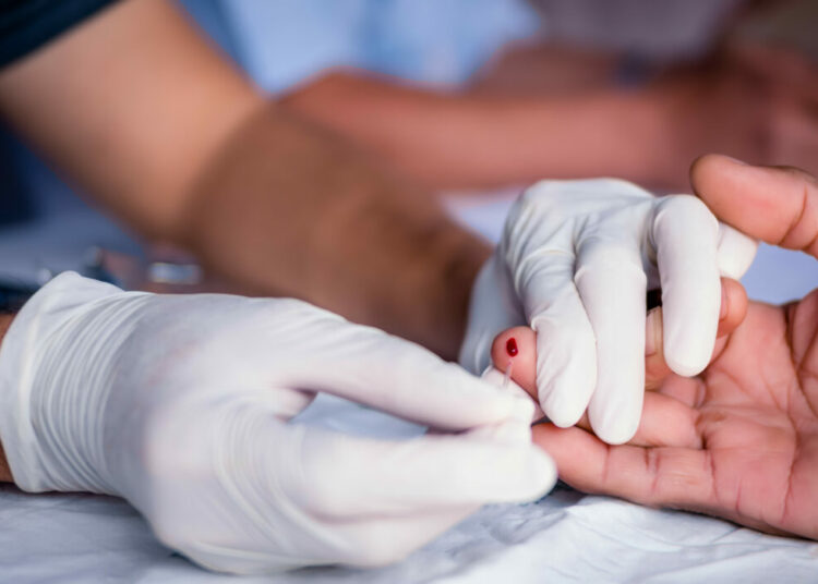 Council Approves Age Consent For HIV Testing 1 rapid HIV testing