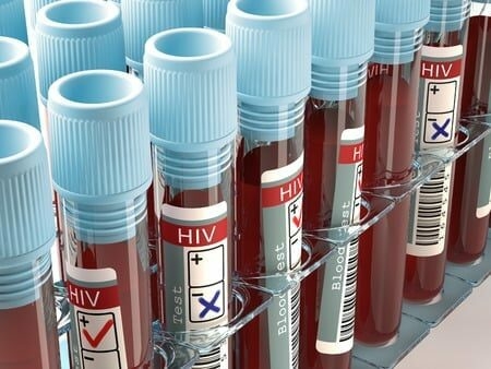 HIV Burden In Yobe Hits 14,262, NEPWHAN Raises Concern 1 HIV testing