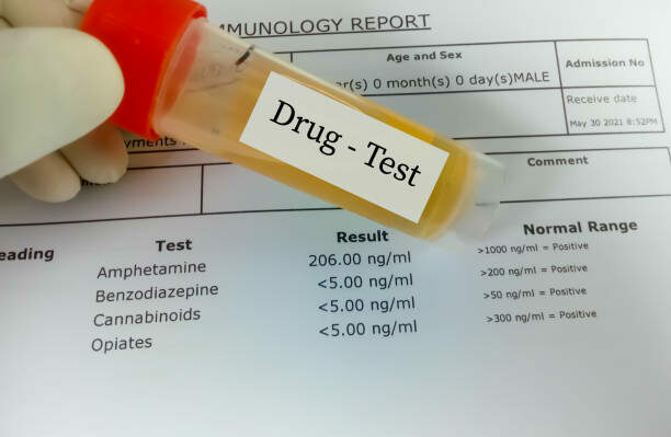 Federal Govt Introduces Drug Test Before Employment 1 istockphoto 1337671785 612x612 1