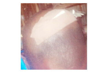 Bello Ismail: Brutalised By Katsina Vigilantes, Cries For Justice