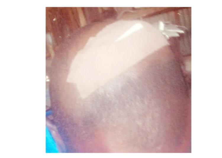 Bello Ismail: Brutalised By Katsina Vigilantes, Cries For Justice 1 bello ismail