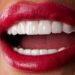 What Is A Hollywood Smile And Who Is It Best Suited For?