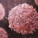 Nearly 4 In 10 Global Cancer Cases Linked To Preventable Causes – WHO
