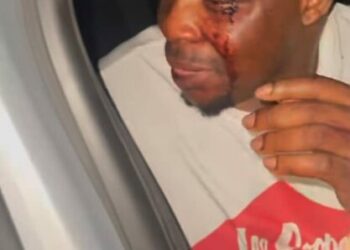 ‘Policemen Attacked Me, Collected My iPhone, Stole My Brother’s $1,200’, Skit Maker Ijoba Lande Cries Out