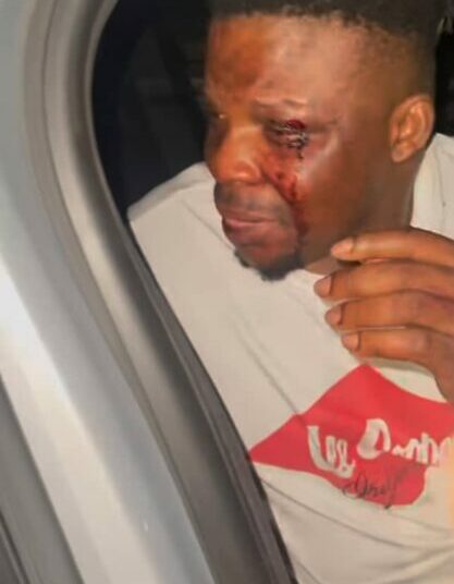 'Policemen Attacked Me, Collected My iPhone, Stole My Brother’s $1,200', Skit Maker Ijoba Lande Cries Out 1 Skit maker