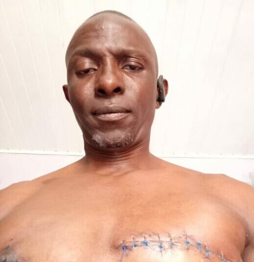 World Cancer Day: I Never Knew Men Could Have Breast Cancer, Patient Shares Painful Journey 1 WhatsApp Image 2026 02 04 at 8.56.51 AM e1770192888746